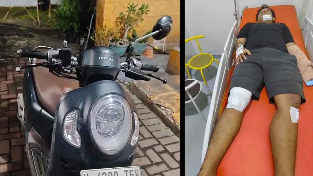 diamankan-motor-honda-scoopy-yang-dikendarai-korban-inset-kondisi-korban-saat-dirawat-xq4da